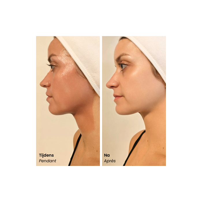 Bio Balance GlycoPro Peel 100 ml