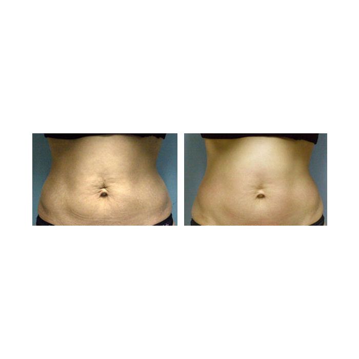 Pollogen legend 4 - showmodel