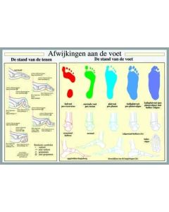 Poster Afwijkingen aan de voet A2